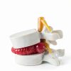 ZITREOXN Human Lumbar Spine Model with Flexible Discs 1pc-0