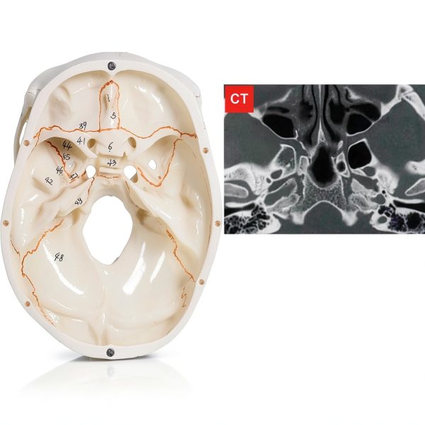 LANDIE Anatomical Skull Model with Magnetic Joints and Movable Jaw-3