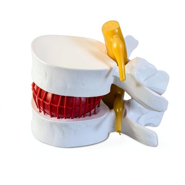 ZITREOXN Human Lumbar Spine Model with Flexible Discs 1pc-1