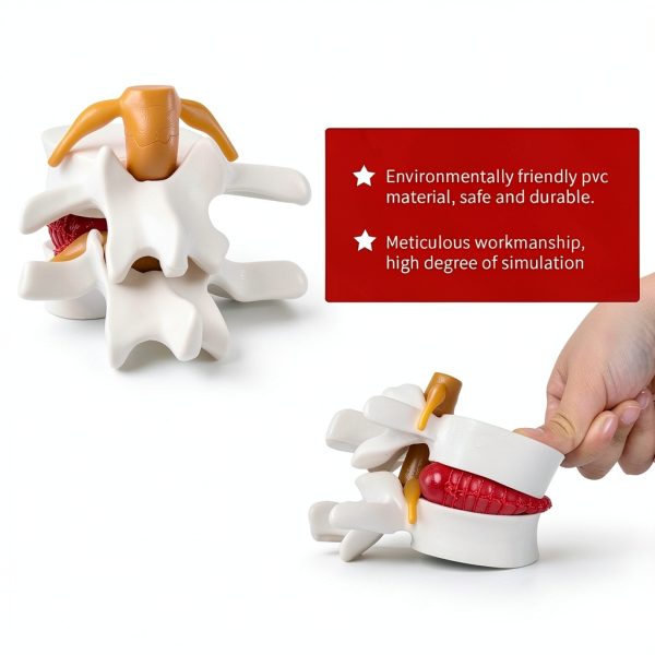 ZITREOXN Human Lumbar Spine Model with Flexible Discs 1pc-3