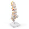 Lumbar Spine Anatomy Model by breesky Life Size PVC 5 Vertebrae-0