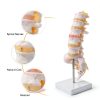 Lumbar Spine Anatomy Model by breesky Life Size PVC 5 Vertebrae-3